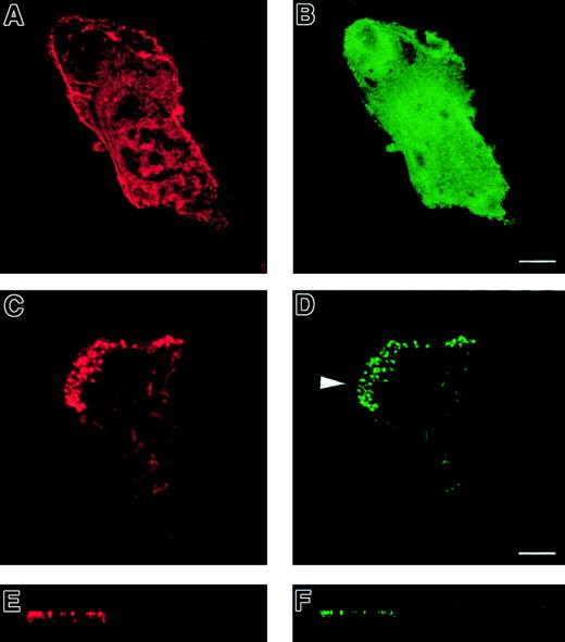 Fig. 5. WASp-null immature DCs expressing a GFP-WASp fusion protein. / WASp-null immature DCs microinjected with a GFP-WASp fusion protein form podosomes and lamellipodia. Confocal images are shown in horizontal (panels A-D) and vertical (panels E-F) planes. TRITC-phalloidin staining of microinjected WASp-null DCs is shown in left-hand panels (panels A, C, E). Right-hand panels show expression of EGFP (panel B) or EGFP-WASp (panels D, F). Confocal images are shown in horizontal (panels A-D) and vertical (panels E-F) planes. Expression of EGFP in WASp-null DCs shows a diffuse distribution within the cytoplasm (panel B). In contrast, expression of EGFP-WASp fusion protein results in the appearance of podosomes at the substratum interface (panels C-F). In addition, EGFP-WASp–expressing cells are capable of forming broad lamellipodia (arrowhead in panel D), behind which the podosomes are located. A normal DC morphology is therefore reconstituted.