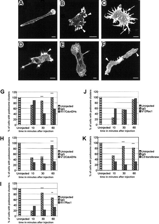 Fig. 6. Role of Rho-family proteins in podosome assembly and distribution. / Rho-family proteins control podosome assembly and distribution in normal immature DCs. DCs were fixed 30 to 60 minutes after microinjection with IgG (panel A), N17Cdc42Hs (panel B), V12Cdc42Hs (panel C), N17Rac1 (panel D), V12Rac1 (panel E), or C3 transferase (panel F) and stained with TRITC-phalliodin. In morphology, the DCs injected with IgG (panel A) are indistinguishable from uninjected cells. N17Cdc42Hs results in a loss of polarity, excessive membrane ruffling (arrowheads in panel B), and loss of podosomes (panel B). Microinjection of V12Cdc42Hs (panel C) stimulates filopodial extension around the periphery of the cell (arrows in panel C), resulting in a characteristic stellate morphology. There are generally fewer podosomes (arrowheads in panel C), and clustering of podosomes is inhibited. Vinculin staining was used to confirm the identity of podosomes (data not shown) in such cells. The leading edge of cells injected with N17Rac1 (panel D) show filopodial extensions (arrowhead in panel D) but lack podosomes. In contrast, V12Rac1 injection causes no morphological change, and normal podosome distribution is retained (panel E). Injection of C3 transferase (panel F) results in cell spreading (arrowheads in panel F), and podosomes are absent. In normal DCs, microinjection of control IgG protein causes partial disruption of podosomes and progressive recovery over 60 minutes (panels G-K). Injection of N17Cdc42Hs (panel G), V12Cdc42Hs (panel H), N17Rac1 (panel I), or C3 transferase (panel K) significantly inhibits podosomal recovery. In contrast, recovery occurs normally in V12Rac1-injected cells (panel J). Data were analyzed by means of the chi-square test. Significant differences between IgG and recombinant protein–injected cells are indicated by asterisks. ** indicates P < .01 and *** indicates P < .05. Each graph represents the combined data from 2 experiments, and each bar represents an average of 102 injected cells.