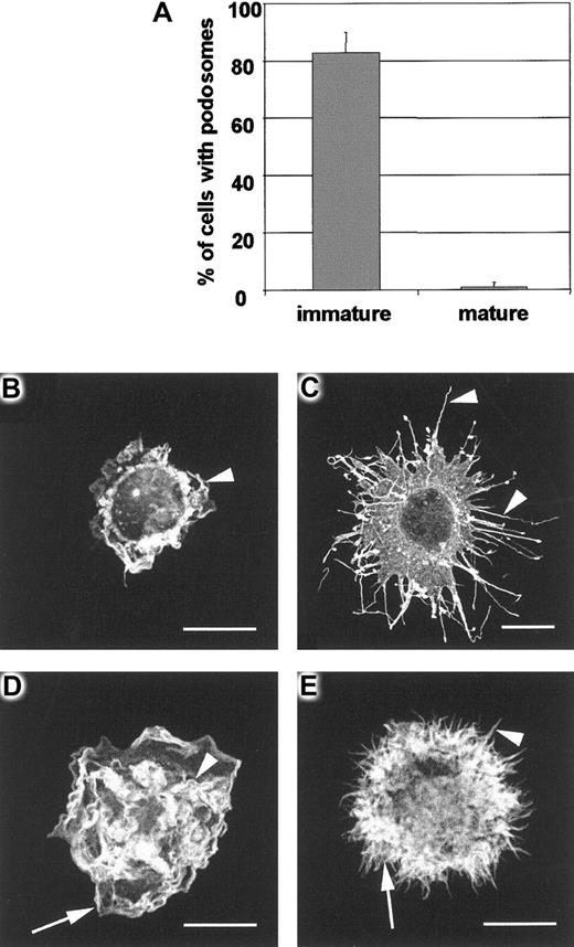 Fig. 7. DC maturation and podosome loss. / Maturation of DCs during 24-hour culture with LPS results in almost complete loss of podosomes (panel A). In contrast with immature DCs, mature DCs are rounded cells that are adhere poorly on fibronectin and have little tendency to spread. IgG-injected mature DCs have the same morphology as uninjected cells, remaining unpolarized and unspread despite displaying active peripheral lamellipodial formation (arrowhead in panel B). Microinjection of V12Cdc42 (panel C) causes striking filopodial assembly (arrowheads in panel C) whereas V12Rac injection (panel D) stimulates vigorous ruffling (arrowhead in panel D) and lamellipodial formation (arrow in panel D). When V12Cdc42 and V12Rac are coinjected (panel E), both filopodia (arrowhead in panel E) and lamellipodia (arrow in panel E) are assembled.