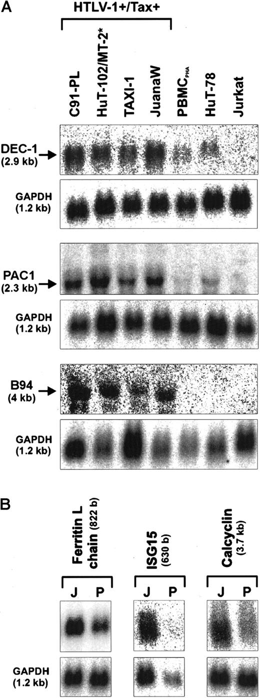 Fig. 1. Up-regulation of transcription factor and signal transduction genes in HTLV-1–infected T lymphocytes. / Total RNA was isolated from HTLV-1+/Tax+(C91-PL, HuT-102, MT-2, TAXI-1, JuanaW) and HTLV-1−/Tax− cell cultures (PBMCPHA, HuT-78, Jurkat), separated on denaturing gels, and subjected to Northern blot analysis. Specific mRNAs of the expected sizes were detected by radioactively labeled cDNAs derived from the transcription factor DEC-1, and signal transduction genes (PAC1, B94, ferritin L-chain, ISG15, and calcyclin). Some of the genes were found to be consistently up-regulated in all Tax+ cells (A); others were preferentially up-regulated in ATL patient-derived cultures (B). Equal RNA loading was controlled by hybridization to an internal standard (GAPDH). Results are representative of 3 independent Northern blots. J indicates JuanaW RNA; P, PBMCPHA RNA. The size of the transcripts is indicated in brackets. *For the B94 expression analysis MT-2 RNA was used instead of HuT-102 RNA.