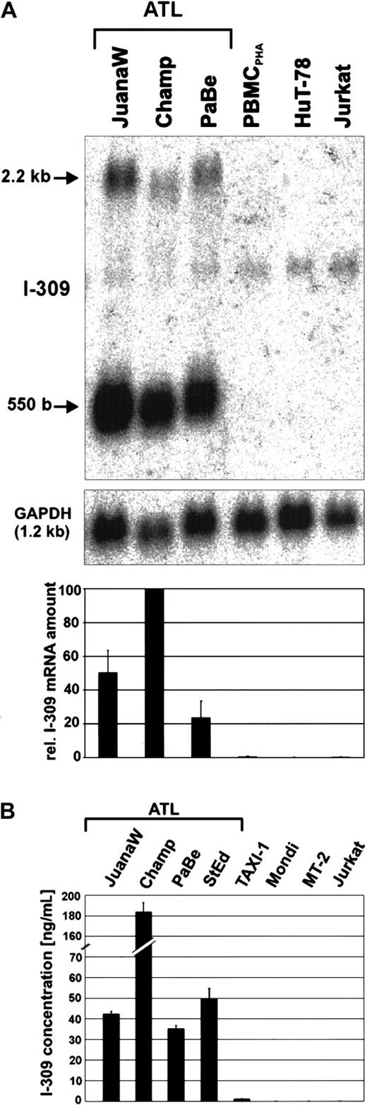 Fig. 2. Overexpression of the chemokine I-309 in ATL-derived cells. / (A) Total RNA derived from ATL cultures (JuanaW, Champ, PaBe) and HTLV-1− reference cells (PBMCPHA, HuT-78, Jurkat) was subjected to Northern blot analysis using an I-309–specific cDNA probe. The top panel shows a representative autoradiograph. The 550-base RNA band was quantified by phosphorimaging. The lower panel depicts the mean RNA levels ± SD resulting from 3 independent experiments. (B) Culture supernatant from ATL cultures (JuanaW, Champ, PaBe, StEd) and reference cells (TAXI-1, Mondi, MT-2, Jurkat) were subjected to antigen capture ELISA. Plates were coated with monoclonal anti–I-309 antibodies and incubated with serial dilutions of the supernatants. Bound I-309 was detected with biotinylated secondary I-309 antibodies. I-309 concentrations were determined using recombinant human I-309 as a standard. The columns show the mean ± SD of 3 independent experiments.