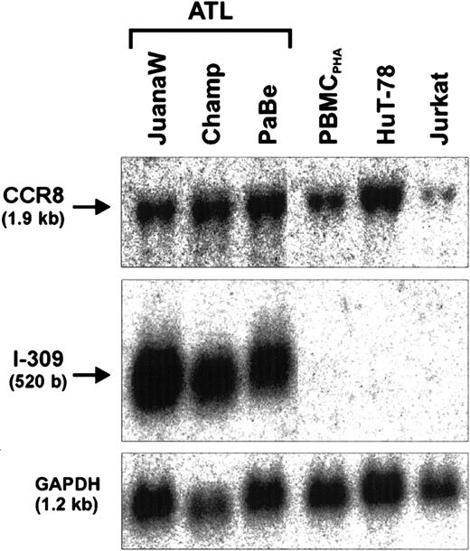 Fig. 4. Coexpression of I-309 and its cognate receptor CCR8. / Total RNA derived from ATL cultures (JuanaW, Champ, PaBe) and HTLV-1− reference cells (PBMCPHA, HuT-78, Jurkat) was subjected to Northern blot analyses. The membranes were sequentially incubated with CCR8-, I-309-, and GAPDH-specific cDNA probes. One representative autoradiograph of 3 experiments is shown.