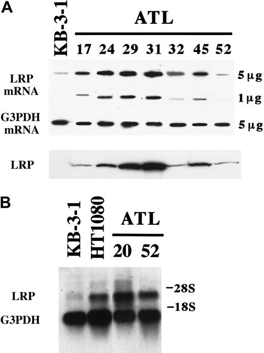 Fig. 1. LRP mRNA expression in ATL cells and cell lines. / (A) Slot blots and immunoblots. Five micrograms and 1 μg total RNA were blotted onto a membrane and hybridized with either LRP or glyceraldehyde 3-phosphate dehydrogenase (G3PDH) RNA probe. Total cell lysates (50 μg) were separated by SDS/polyacrylamide gel electrophoresis and transferred to PVDF membrane. LRP levels were determined by polyclonal antibody against LRP. (B) Northern blots. One microgram mRNA was applied to each well and hybridized with LRP RNA probe. The position of 3.5-kb LRP mRNA is indicated. A G3PDH RNA probe was used as the control probe.