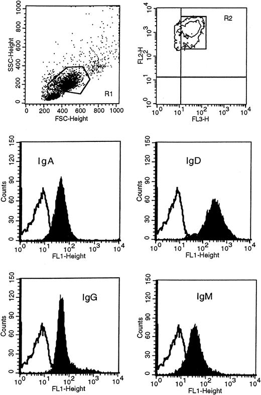 Fig. 1. Immunophenotypic analysis of isotype proteins on HCs. / HCs were identified in the R1 region as CD11c+ (FL2) and CD19+ (FL3) and gated in R2. Cells in R1 and R2 were then analyzed for the surface expression of IgM, IgD, IgG, and IgA with FITC(FL1)-conjugated F(ab′)2 monoclonal antibody specific to each class. This example represents patient 163. The unfilled curves in the histogram plots represent the isotype control.
