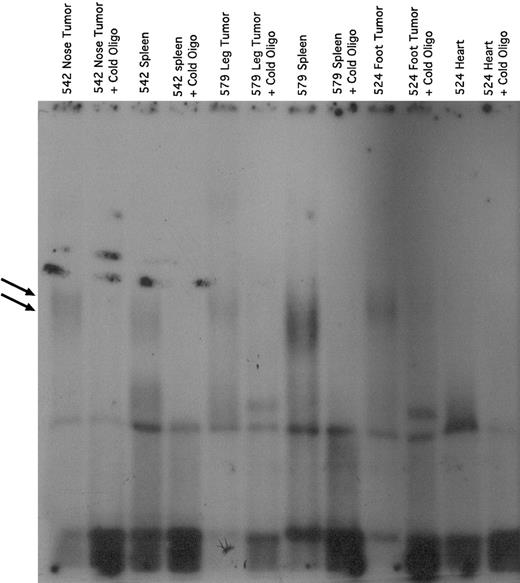 Fig. 1. NF-κB activity in Tax transgenic mouse tumors. / Nuclear extracts were prepared from Tax transgenic tissues, and representative results from 3 animals (#524, #542, and #579) are shown. Tissues used included tumors arising on the nose, leg, or foot, as well as spleens with tumor involvement or uninvolved heart tissue. Electrophoretic mobility gel-shift assays were performed in the absence or presence of 100-fold excess of unlabeled oligonucleotide (indicated as “+ Cold Oligo”). The positions of the retarded NF-κB-DNA bands are indicated by the arrows on the left, indicating the positions of DNA bound to the p65-p50 heterodimer and p50-p50 homodimer of NF-κB.