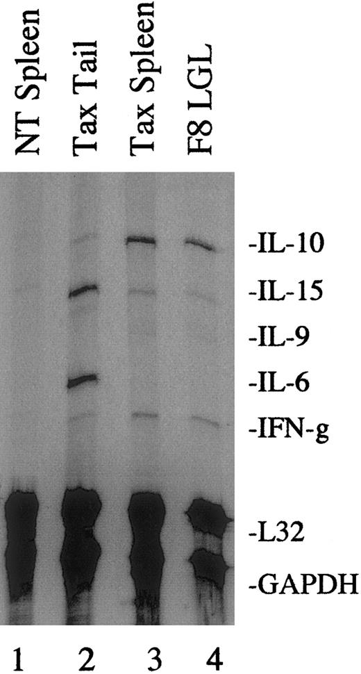 Fig. 2. Cytokine mRNA expression in Tax transgenic mouse tumors. / Total RNA (10 μg) was extracted from fresh NT (lane 1) and Tax transgenic mouse tissues (lanes 2 and 3) or from the tumor-derived F8 LGL cell line (lane 4) and used in RNase protection assays using a multiprobe cytokine system. The L32 and GAPDH probes were used to demonstrate equivalent RNA levels in each sample. A total of 4 primary Tax-induced tumors and 5 Tax spleens were analyzed, and a representative gel is shown.