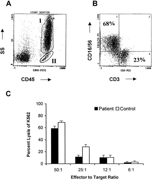 Fig. 2. Malignant cells display phenotypic and functional properties characteristic of natural killer cells. / (A) FACS light scatter profile and CD45 expression of freshly isolated cells from the patient's peripheral blood leukopheresis product. Cells located in region I represent malignant leukocytes. Cells located in region II represent normal lymphocytes. (B) FACS analysis of cells in region I demonstrates that a majority of neoplastic cells express CD16/56 but lack CD3 surface expression consistent with the phenotype of a NK cell. (C) Percentage of specific lysis of NK-sensitive K562 cells by unstimulated patient malignant cells (▪) versus control peripheral blood mononuclear cells (■) at various effector-to-target ratios as determined by a standard 4-hour chromium release NK cell assay.