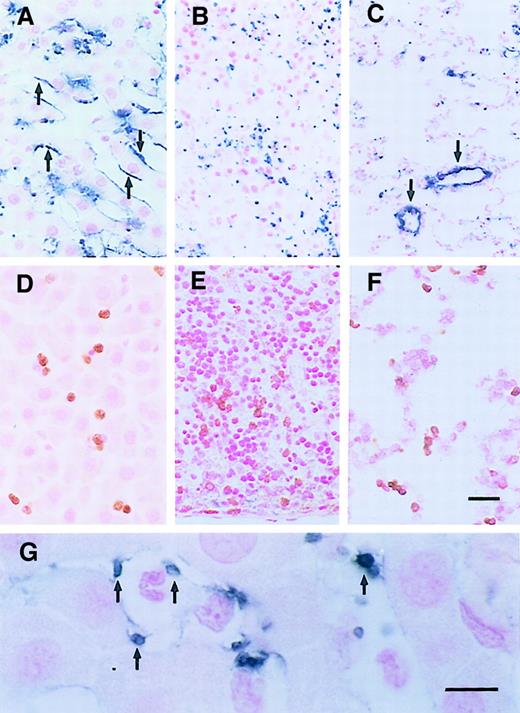 Fig. 1. Localization of P-selectin, PMNs, and platelets 6 hours after LPS injection. / (A) P-selectin was expressed on sinusoidal endothelia of the liver (arrows), not the splenic sinusoids (B), nor the pulmonary capillaries (C), although some trapped platelets (B, blue spots) and large vessels (C, arrows) were labeled. (D) PMNs were labeled with Ab HIS48 (brown) in the hepatic sinusoids, splenic sinusoids (E), and pulmonary capillaries (F). (G) Platelets in hepatic sinusoids were labeled by MoAb CD61 (arrows). Scale bars, panels A-F, 20 μm; panel G, 10 μm.