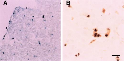 Fig. 3. In situ annexin V binding and DNA nick end-labeling assay 6 hours after LPS injection. / (A) A number of annexin V binding-positive cells (blue spots) were in the liver. (B) Double staining showed apoptotic PMNs (black) were phagocytosed by Kupffer cells (brown). Scale bar, 20 μm.