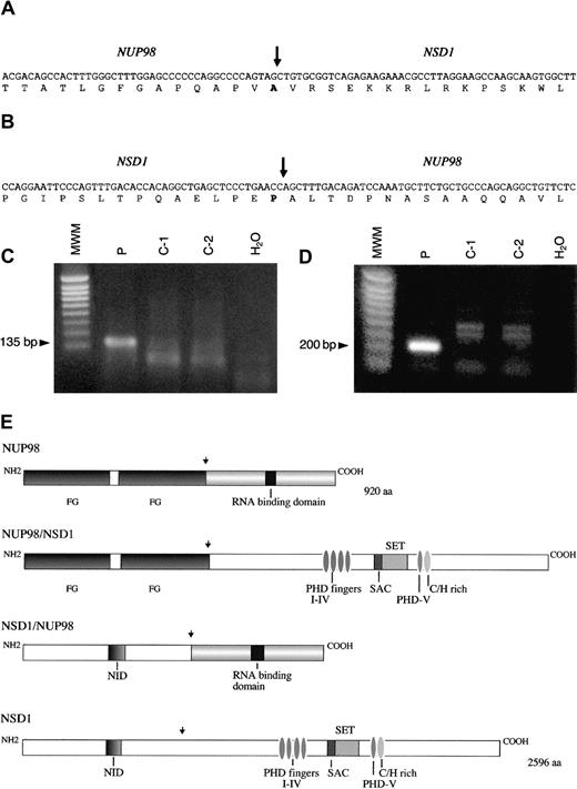 Fig. 2. NUP98-NSD1 and NSD1-NUP98 fusion cDNA. / Nucleotide and amino acid sequences around the junction of (A)NUP98-NSD1 fusion transcript and (B) NSD1-NUP98fusion transcript. The NUP98 and NSD1 fusion points are shown by a vertical arrow. (C) RT-PCR assay forNUP98-NSD1 fusion mRNA. Primers NUP98-5 and NSD1-1 were used to amplify the 135 bp fusion mRNA. (D) RT-PCR assay forNSD1-NUP98 fusion mRNA. Primers NSD1-2 and NUP98-6 were used to amplify the 200 bp fusion mRNA. No specific products of the expected size are seen in the normal controls (C1-C2) and negative controls (H2O) in panels C and D. MWM indicates 1 kb ladder molecular weight marker. (E) Schematic representations of the wild-type NUP98, NSD1, and fusion NUP98-NSD1, NSD1-NUP98 proteins. Functional domains indicated for NUP98 are FG repeat regions at the N-terminus and RNA binding domain at the C-terminus. Domains for NSD1 are N-terminus, nuclear receptor interaction domain (NID), PHDI-IV fingers, SET and SAC domains, PHDV finger, and cysteine-histidine (C/H)-rich motif, and C-terminus. Functional domains of NSD1 are similar to the murine Nsd1 as designated in reference 17. NUP98 and NSD1 fusion points are shown by a vertical arrow.