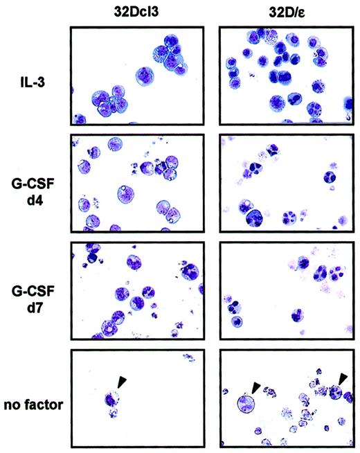 Fig. 3. Priming of 32D/ε cells for granulocyte differentiation. / Shown are the morphologic characteristics of parental 32Dcl3 cells and 32D/ε cells maintained in IL-3, treated with 50 ng/mL G-CSF for the period indicated (d4 indicates 4 days; and d7, 7 days), and cultured in medium without cytokines (no factor) for 4 days. The morphologic features of the cells were visualized using Wright-Giemsa staining (original magnification, ×400).