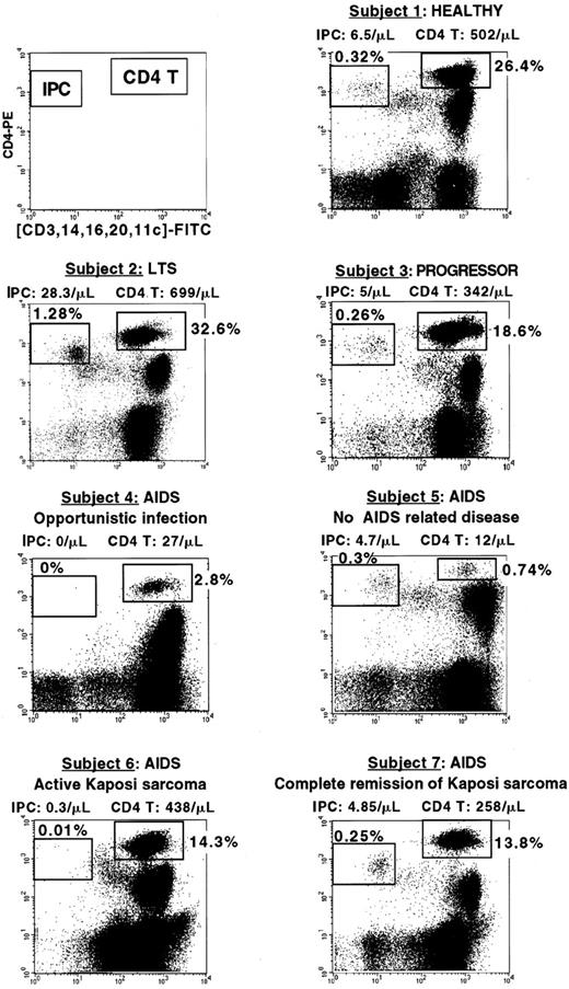 Fig. 5. Percentage of IPCs and CD4+ T cells in HIV-infected subjects at different clinical stages. / The clinical status, IPC, and CD4+ T-cell count of each subject are indicated. Subject 1 (healthy) and subject 3 (progressor) have comparable percentage and number of IPCs (0.32%, 6.5 cells/μL versus 0.26%, 5 cells/μL) and T cells (26.4%, 502 cells/μL versus 18.6%, 342 cells/μL). Subject 2 (LTS) has a very high IPC percentage and number (1.28%, 28.8 cells/μL). Subject 4 (AIDS with opportunistic Pneumocystis carinii infection) has undetectable IPCs and very low CD4+ T cells (2.8%, 27 cells/μL). Subject 5 who was diagnosed as AIDS because of very low CD4+ T cells (0.74%, 12 cells/μL) has conserved IPCs (0.3%, 4.7 cells/μL) and no AIDS-related disease. Subject 6 (AIDS with active Kaposi sarcoma) has low IPCs (0.01%, 0.3 cells/μL) but normal CD4 T cells (14.3%, 438 cells/μL). Subject 7 (had a history of Kaposi sarcoma but had been in complete tumor remission for the past 7 years) has both conserved IPC number (0.25%, 4.85 cells/μL) and CD4+ T cells (13.8%, 258 cells/μL).