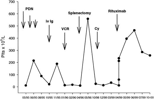 Fig. 2. Clinical course of a patient with chronic ITP responding to rituximab. / (See text for details.)