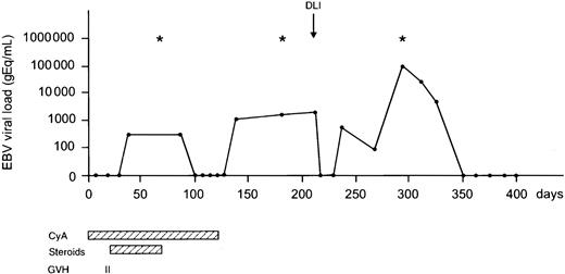 Fig. 2. Monitoring EBV load after matched unrelated SCT. / A 16-year-old EBV-seropositive male with a Philadelphia chromosome–positive (Ph+) ALL in first complete remission received a TCD matched unrelated donor graft from an EBV-seropositive donor. Multiple EBV reactivations were observed; however, no EBV-LPD ensued. Frequent examination of bone marrow for the presence of monoclonal B cells and whole-body CT to detect lymphadenopathy were negative at various time points (*). At day 211, DLI (1.0 × 105 CD3+ T cells/kg) was administered because of molecular relapse of his Ph+ ALL. Currently, the patient is free of disease and well at day 800 after SCT. CyA indicates cyclosporin A.