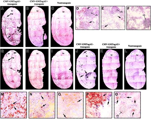 Fig. 4. Phenotype of CMV-GMTag AU+ and AU− E14 transgenic embryos. / (A-C) Immunohistochemical detection (black peroxidase staining) of mature granulocytes using Gr1 antibody in CMV-GMTagAU−(A), CMV-GMTagAU+ (B), or nontransgenic (C) embryos. Gr1+ cells appear like black points forming dark areas (magnification × 5). (D-F) Immunohistochemical analysis at greater magnification (× 200) of Gr1+ cells (brown peroxidase staining) in vertebra area of CMV-GMTagAU− (D), CMV-GMTagAU+ (E), or nontransgenic (F) embryos. (G-I) Immunohistochemical detection of macrophages using F4/80 antibody in CMV-GMTagAU− (G), CMV-GMTagAU+ (H), or nontransgenic (I) embryos (black peroxidase staining). (J-L) Detection of endogenous peroxidase activity by histochemistry. Peroxidase-positive cells appear as black spots. (J) CMV-GMTagAU− transgenic embryo; (K) CMV-GMTagAU+ transgenic embryo; (L) nontransgenic embryo. (M-O) analysis of peroxidase-positive cells (brown peroxidase staining) at greater magnification (× 200) in the liver of CMV-GMTagAU− (M), CMV-GMTagAU+ (N), and nontransgenic (O) embryos. (P,Q) Double staining showing different localization of Gr1+ cells (blue alkaline phosphatase staining) and peroxidase-positive cells (brown peroxidase staining), in the liver (P) and close to vertebral bone (Q) of E14 CMV-GMTagAU− transgenic embryo. Arrows point to stained organs (A-C, G-L) or to stained cells (D-F, M-Q). br indicates brain; PM, pia mater; vb, vertebral bone. The phenotypes illustrated in this figure are representative of the different embryos analyzed.