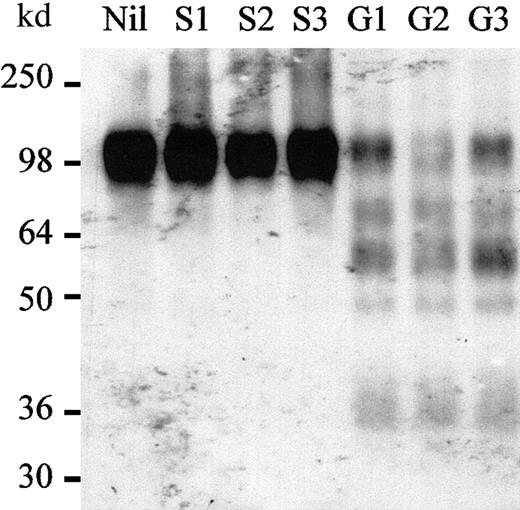 Fig. 3. Proteases cleaving rhuVCAM-1 accumulate in BM of G-CSF–mobilized mice. / rhuVCAM-1 was incubated for 15 minutes at 37°C in the presence of either PBS (Nil), BM extracts from 3 different mice injected for 6 days with saline (S1, S2, S3), or from 3 different mice injected for 6 days with G-CSF (G1, G2, G3), and analyzed by Western blot.