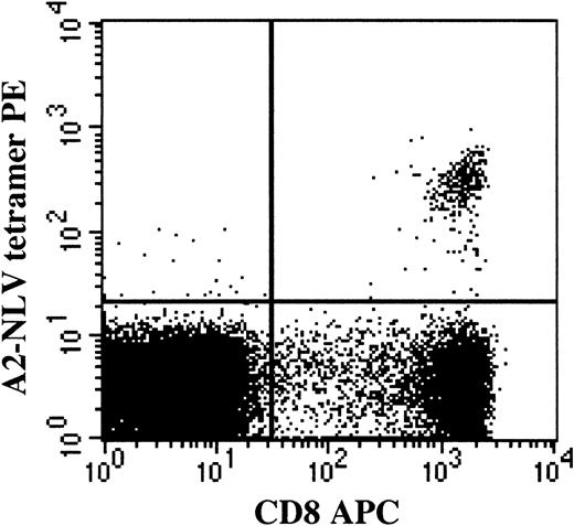 Fig. 1. T lymphocytes binding the HLA-A2 NLVPMVATV (A2-NLV) tetramer are CD8bright and not CD8dim. / Following acquisition of a list mode data file containing 20 000 viable CD8+ lymphocytes, viable cells were selected on the basis of 7-AAD negativity (Gate 1). Among the viable mononuclear cells, CD8+ lymphocytes were selected on the basis of CD8 expression and a low sideward scatter signal (Gate 2). Lymphocytes fulfilling the criteria of Gates 1 and 2 are displayed in the figure. The percentage of A2-NLV–specific CD8+ T lymphocytes was assessed and expressed as a fraction of viable CD8+lymphocytes by using quadrant statistics. PE, phycoerythrin; APC, allophycocyanin.