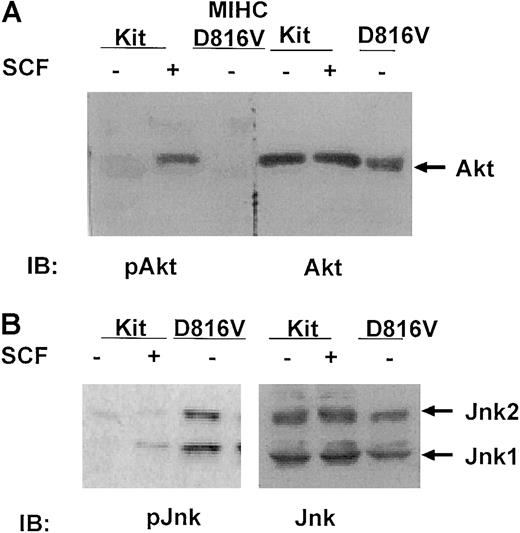 Fig. 4. Jnks are constitutively phosphorylated in MIHC expressing D816V c-Kit, but Akt is not. / (A) Akt is not activated in MIHC-D816V cells. Indicated cells were incubated in the presence or absence of huSCF for 10 minutes and lysed. Equivalent amounts of protein from the clarified lysates were resolved with SDS-PAGE, transferred to Immobilon, and immunoblotted (IB) with antisera specific for either phosphorylated or total Akt. Proteins were visualized with ECL. (B) Jnks are constitutively activated in MIHC-D816V cells. Equivalent amounts of protein from clarified lysates were resolved with SDS-PAGE, transferred to Immobilon, and immunoblotted (IB) with antisera specific for either phosphorylated or total Jnks. Proteins were visualized with ECL.
