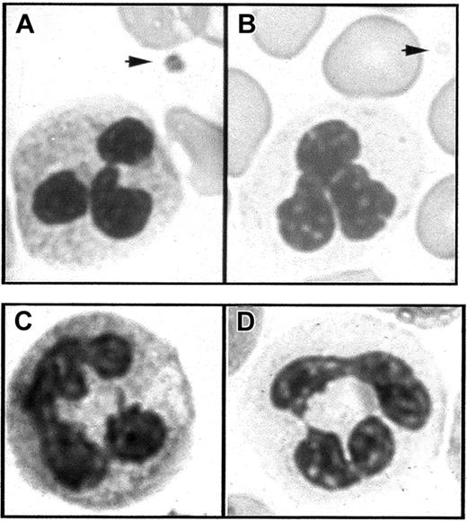 Fig. 1. Light microscopy of blood smears. / (A) In Romanovsky-stained smears from a normal subject, the PMNs have a granular cytoplasm and a platelet displays granules in the cytoplasm (arrow). (B) In similarly stained smears from a patient with GPS, the PMN cytoplasm appears agranular and platelets are also degranulated (arrow). (C,D) Cytochemical detection of leukocyte alkaline phosphatase. PMN staining intensity is easily detected in the normal state (C) but strongly decreased in GPS compared to normal neutrophils (D).