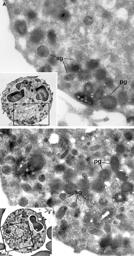 Fig. 2. Electron microscopic view of the blood PMNs that have been cytochemically reacted for MPO and immunolabeled for lactoferrin. / (A) Patient PMNs display normal primary electron dense granules that have been opacified by the cytochemical MPO reaction and appear dark gray (pg); secondary lactoferrin-containing granules (sg) (identified by immunogold particles) are decreased in number and look larger than normal. (B) Control PMNs contain numerous lactoferrin-positive secondary granules (sg), as well as primary dark MPO+granules (pg). (Panels A and B, original magnification × 31 000; insets, × 4600.)