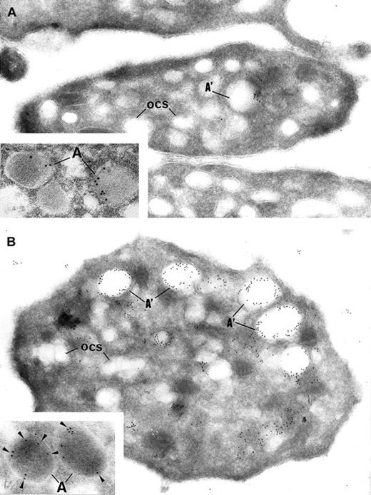 Fig. 4. Immunoelectron microscopy. / Gray platelets immunolabeled for vWF (A) and P-selectin (B). (A) Immunolabeling for the secretory protein vWF is virtually absent from gray platelets; only trace amount of labeling is found in structures resembling empty α-granules (A′); ocs indicates open canalicular system. (B) P-selectin is immunodetected in the membrane of empty vacuolar structures, such as identified as α-granules (A′) deprived of soluble content. Insets show normal platelet α-granules immunolabeled for vWF and P-selectin. (Panels A and B, original magnification × 40 300; insets, × 65 000.)