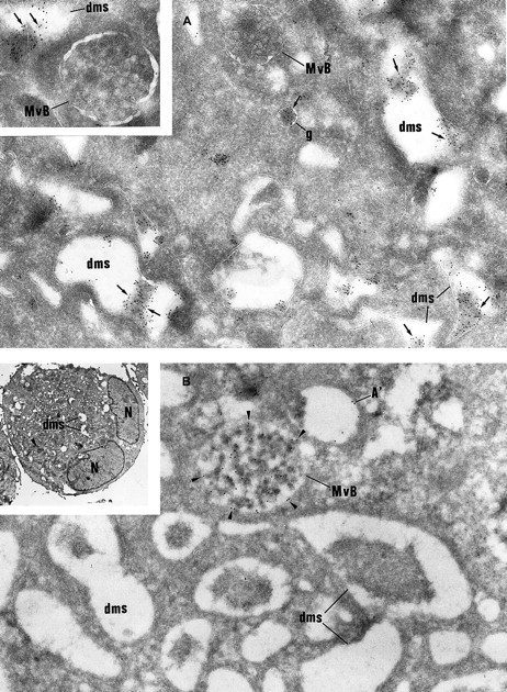 Fig. 5. Immunolabeling of GPS MKs. / (A) vWF immunolabeling is found in small granules (g) often located near the Golgi complex and in the lumen of the demarcation membrane system (dms). Multivesicular bodies (MvB) are consistently negative (original magnification × 37 000; inset, × 46 000). (B) P-selectin is detected within multivesicular bodies (MvB) and in some vacuolar structures (A′) the size of normal α-granules. The demarcation membrane system (dms) is free of labeling (original magnification × 37 000; inset, × 2000).