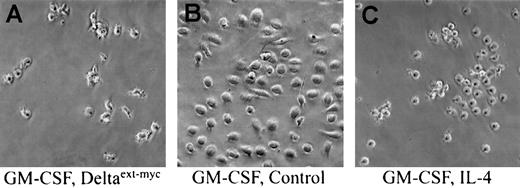 Fig. 1. Effect of immobilized Deltaext-myc on differentiation of monocytes cultured with GM-CSF. / Phase contrast microscopy of cells derived from monocytes cultured for 6 days with GM-CSF and 1 μg/mL Deltaext-myc (A), GM-CSF and control medium (B), or GM-CSF and IL-4 (C). Tissue culture wells were coated with anti-myc antibody, 9E10 F(ab′)2, to attach myc-containing Deltaext-myc to the plastic surface (original magnification × 200).