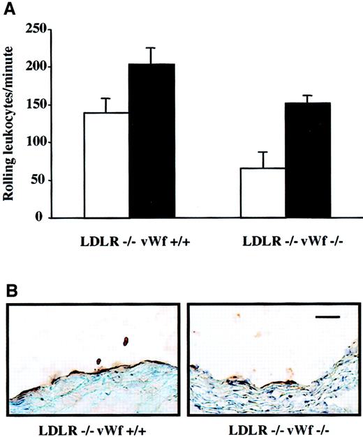 Fig. 1. Effect of vWf deficiency on P-selectin expression. / (A) Leukocyte rolling in LDLR-deficient mice on an atherogenic diet. Four-week-old LDLR−/−vWf+/+ and LDLR−/−vWf−/− mice were fed either normal mouse chow (white bars) or atherogenic diet (black bars) for 4 weeks. Animals were injected with 6 g rhodamine, and the mesenteric venules were exposed. The number of leukocytes was quantified by counting the number of cells passing through a perpendicular plane per minute. The atherogenic diet significantly increased rolling in both LDLR−/−vWf+/+ (P = .03) and LDLR−/−vWf−/− (P = .0004) mice (n = 6-9). The number of rolling leukocytes was comparable in the 2 genotypes of mice on atherogenic diet (P = .1). (B) Immunohistochemical staining of the aortic sinus with an anti–P-selectin antibody. Sections were obtained from mice that were on an atherogenic diet for 4 weeks and were stained with a polyclonal antibody against P-selectin. Staining for P-selectin was weaker in mice lacking vWf. Immunohistochemical staining with a PECAM-specific antibody confirmed the integrity of the endothelial monolayer (not shown). Bar = 100 μm.