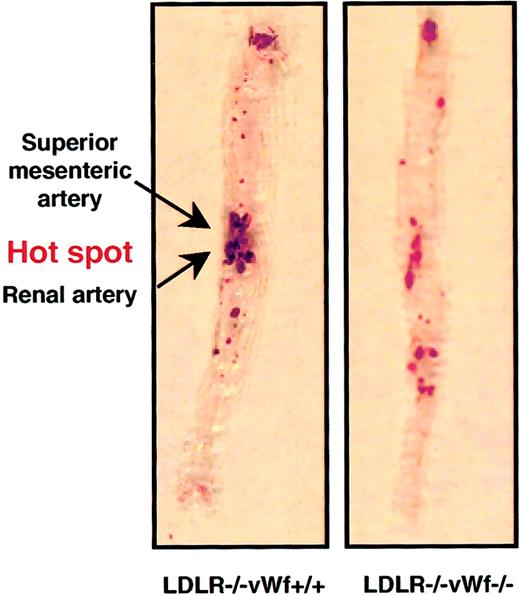 Fig. 3. Distribution of atherosclerotic lesions in the aorta of LDLR−/− vWf+/+ and LDLR−/−vWf−/− mice. / Eight-week-old mice were fed an atherogenic diet for 22 weeks. Aortas were collected between the subclavian and iliac branches and stained with Sudan IV. The area between and around the superior mesenteric artery and renal artery, which is highly prone to lesion formation (see “Materials and methods”) is referred to as the hot spot. The percentage of coverage for LDLR−/− vWf−/− is 16 ± 2.6 and 15.2 ± 1.9, respectively; P = .79. The percentage of the lesion in the hot spot is 48.4 ± 5.4 and 33.7 ± 3.1, respectively; P = .02. Representative specimens from both genotypes are shown, and mean values from 16 to 17 animals of each genotype are given.