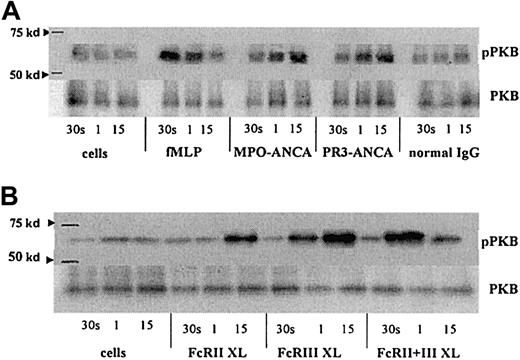 Fig. 6. PKB activation in fMLP, ANCA, and FcγR cross-linked neutrophils. / Phospho-PKB (pPKB) levels were assessed in blots of PKB immunoprecipitates from primed neutrophils stimulated with either (A) 1 μM fMLP, 250 μg/mL MPO-ANCA, PR3-ANCA, or normal IgG or (B) 1 μg/mL anti-FcγRII, 1 μg/mL anti-FcγRIII, or 1 μg/mL of both anti-FcγR monoclonal antibodies followed by 10 μg/mL GAM F(ab′)2 cross-linking antibody for 30 seconds, 1 minute, and 15 minutes. Molecular weight (kd), as assessed using Rainbow markers (Amersham), are shown on the left. Levels of PKB are also shown to indicate equal amounts of protein within the samples. These results are representative of 3 independent experiments.