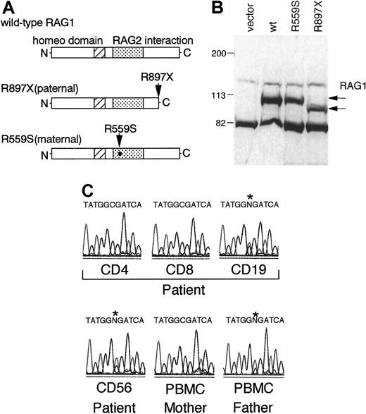 Fig. 2. Characterization of RAG1 mutations of the patient. / (A) Schematic representations of mutant RAG1 proteins. Arrows indicate the parental mutations. (B) Steady-state levels of the mutant and wild-type RAG-1 proteins in transfected 293T cells. Protein from transfected 293T cells was detected by immunoblotting with polyclonal anti-RAG1 antibodies. (C) The paternal mutation was not detected in CD4+ and CD8+ T cells from the patient. Cells were purified by positive magnetic immunoselection by using anti-CD4, anti-CD8, anti-CD19, and anti-CD56 microbeads, and direct sequencing was performed on the PCR products by using genomic DNAs isolated from the fractionated PBMCs. An asterisk indicates the position of the paternal mutation.