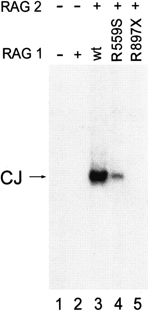 Fig. 3. In vivo recombination activity of the RAG1 mutants. / Harvested plasmids were analyzed for coding joint (CJ) formation by PCR. The PCR products were run on a 5% polyacrylamide gel and autoradiographed. Full-length wild-type (wt) and mutant alleles (R559S, R897X) were transfected into 293T cells with pEBG and deletion substrate pJ200. Lane 1: negative control; Lane 2: negative control; Lane 3: positive control (wild-type RAG1 cotransfected with wild-type RAG2); Lane 4: mutant R559S cotransfected with wild-type RAG2; Lane 5: mutant R897X cotransfected with wild-type RAG2.