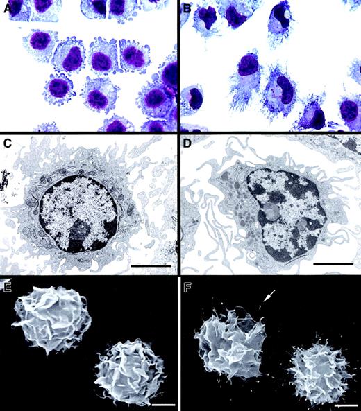 Fig. 3. Morphology and ultrastructure of CD86− BM DCs and CD86+ BM DCs. / CD86− DCs exhibited short, blunt prolongations (A), a round nucleus with prominent nucleoli, multiple cytoplasmic vesicles, mitochondria, few lysosomes (C), and typical “veils” (E). After maturation, CD86+ DCs showed a typical dendritic morphology, with an eccentric, indented nucleus (B, D) and a veiled surface with delicate filamentous projections with knoblike tips (F, arrow). (A-B) May-Grünwald-Giemsa. (C-D) TEM ×6000. (E-F) SEM ×3500). Bar, 5 μm.