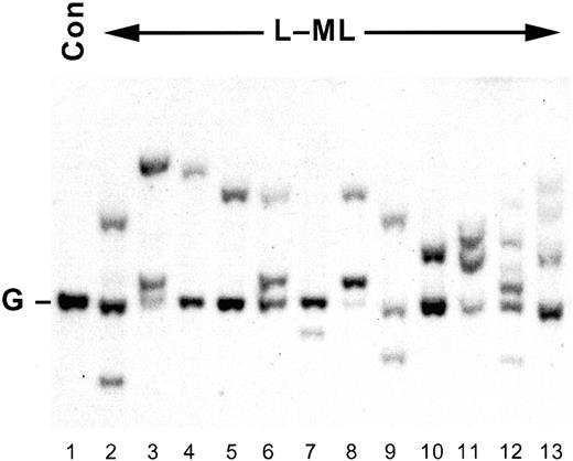 Fig. 1. IgH gene rearrangements. / Representative Southern blot analysis of EcoRI- andBamHI-digested genomic DNA (approximately 15 μg) prepared from control spleen (lane 1) or L-MLs (lanes 2-13). DNA was resolved by 1% (wt/vol) agarose gel electrophoresis, blotted, and probed with p5′(JH).1419 G, IgH gene germline configuration; Con, control spleen.