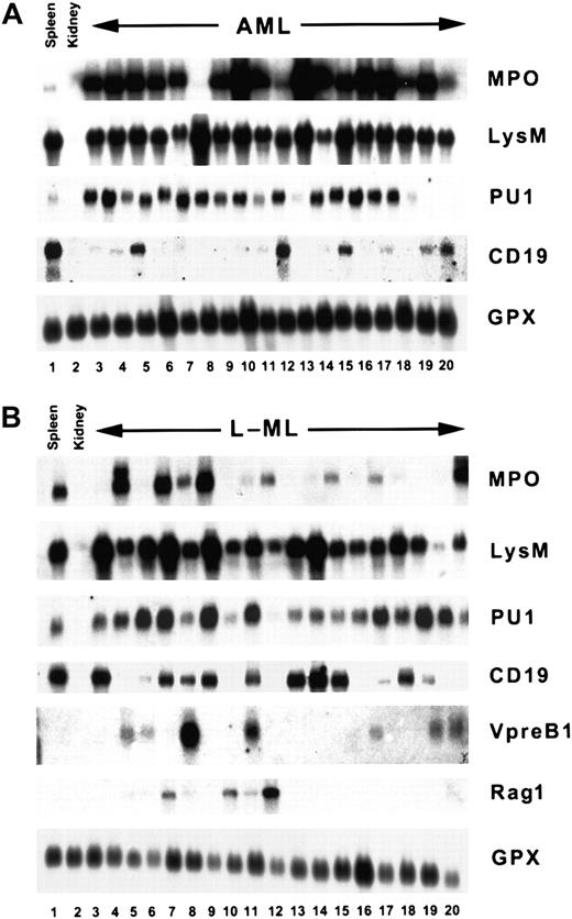 Fig. 2. AML and L-ML mRNA expression profiles. / Representative Northern blots containing total cellular RNA (approximately 20 μg) prepared from control spleen or kidney. (A)IgHG leukemias. (B) IgHRleukemias. Separate blots were probed with myeloperoxidase (MPO), lysozyme M (LysM), CD19, PU1, Vpre-B1, Rag1, or glutathione peroxidase cDNA probes. Quantitation of the Northern blots is summarized in Table 3.