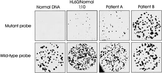 Fig. 3. Representative allele-specific oligonucleotide plaque hybridization for quantitation of N-ras gene mutations. / Duplicate filters hybridized with allele-specific mutant and wild-type oligonucleotide probes for N-ras codon 61. Samples: 1, normal DNA; 2, positive control—10% HL60 in normal DNA; 3 and 4, representative patient samples A and B (patients 11 and 32, Table 2).