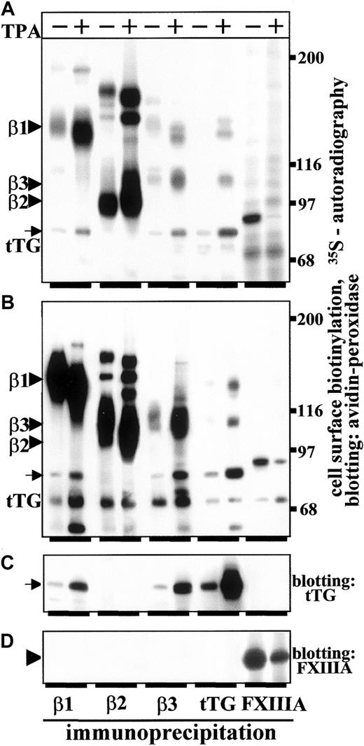 Fig. 1. Monocyte differentiation elevates biosynthesis of tTG and increases surface expression of tTG and the amounts of integrin-tTG complexes. / Untreated THP-1 cells (−TPA) and THP-1 cells induced to differentiate by plating on Fn for 72 hours in the presence of 150 ng/mL TPA (+TPA) were analyzed. The β1-, β2-, and β3-integrins, tTG, and FXIIIA were immunoprecipitated from RIPA lysates of 35S-labeled (A) or surface-biotinylated (B-D) untreated or TPA-treated cells. (A) Autoradiographs of 35S-labeled immune complexes analyzed by SDS-PAGE and fluorography. (B) Surface-biotinylated proteins were immunoprecipitated, separated by SDS-PAGE, and blots developed with avidin-peroxidase. To detect tTG and FXIIIA in the immunoprecipitates, the same blots as in panel B were developed with mAb TG100 against tTG (C) or polyclonal antibody to FXIIIA (D). Note an up-regulation of tTG biosynthesis and elevated amounts of tTG complexed with β1- and β3-integrins during biosynthesis in TPA-treated THP-1 cells (A, arrow). Similarly, there is an increase in surface-expressed tTG and the amounts of β1-integrin-tTG and β3-integrin-tTG complexes on the surface of THP-1 cells in response to TPA treatment (B,C, arrows). In contrast, there is a decrease in biosynthesis (A) and surface expression (B) of FXIIIA in TPA-treated THP-1 cells. Arrowhead in panel D points to FXIIIA, which does not associate with integrins. Molecular weight markers in panels A and B are shown to the right of the gels.