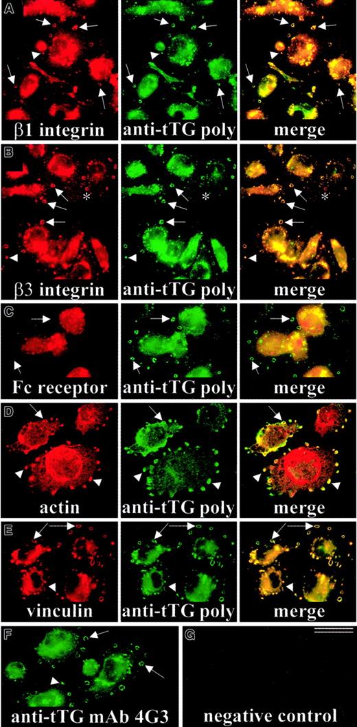 Fig. 3. Localization of tTG on the surface of THP-1 macrophages adherent on Fn. / THP-1 monocytic cells were induced with 150 ng/mL TPA and plated on Fn-coated coverslips for 72 hours. Live nonpermeabilized cells were double-stained for β1-integrins and tTG (A), β3-integrins and tTG (B), or FcγRI receptor and tTG using polyclonal anti-tTG antibody (C). Note an extensive colocalization of tTG with β1- and β3-integrins on the surface of THP-1 macrophages and their specific accumulation in podosomes (arrows, arrowheads). Alternatively, live nonpermeabilized cells were stained for surface tTG with polyclonal antibody, fixed, permeabilized, and then costained for F-actin (D) or vinculin (E). The mAb 4G3 also revealed localization of tTG in podosomes of THP-1 macrophages (F), whereas incubation without primary and with secondary antibody only (fluorescein isothiocyanate–labeled anti–rabbit IgG) resulted in negative background staining and no detectable staining of podosomes (G). Arrows point to ringlike and arrowheads mark round-shaped podosomes. Asterisk marks a podosome containing β3-integrins, but little or no tTG. Bar indicates 25 μm.