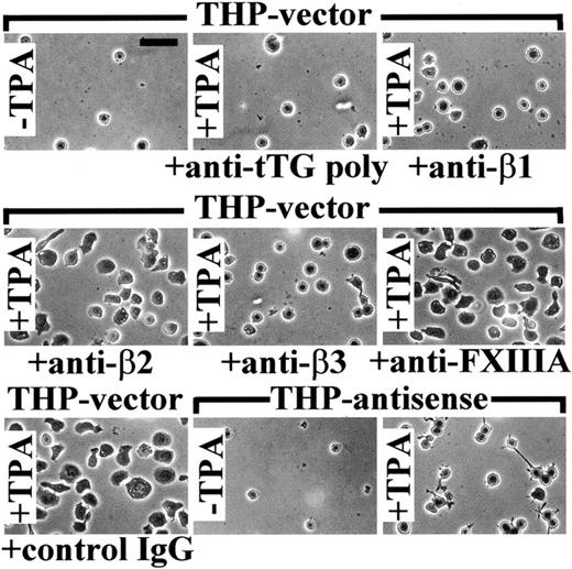 Fig. 6. Blocking antibody against tTG and expression of antisense tTG construct inhibit spreading of TPA-stimulated THP-1 cells on Fn. / The 5 × 103 THP-vector and THP-antisense cells, either untreated (−TPA) or treated for 1 hour with 150 ng/mL TPA (+TPA), were plated for 12 hours at 37°C in serum-free AIM-V medium containing 0.5% BSA on Fn-coated wells. Some samples of THP-vector cells were preincubated for 1 hour with function-blocking polyclonal anti-tTG antibody, blocking mAbs against β1-, β2-, or β3-integrins, antibody against FXIIIA, or control nonimmune IgG, before plating on Fn. The antibodies were present in the medium during the assay. Adherent cells were washed with PBS, fixed with paraformaldehyde, stained with Coomassie brilliant blue, and photographed. Bar indicates 50 μm.