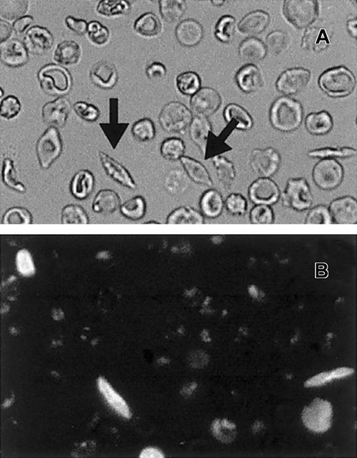 Fig. 5. Morphologic comparison of biotinylated cells. / Corresponding visual fields from bright-field (A) and fluorescent (B) micrographs of Oregon green streptavidin–labeled RBCs recorded at 3 days after biotinylation. Typical ISCs are indicated by arrows in panel A.