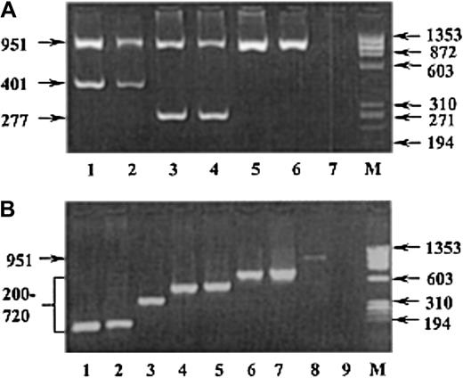 Fig. 1. Representative gel electrophoretograms showing PCR-ASP screening for subgroup alleles. / PCR-ASP amplification products for A and B subgroup alleles with the W1 (A) and W3 (B) primer mixes, respectively, as separated on 2% agarose gels. The W2 primer mix gel is not shown because it works according to the same principle and looks virtually identical to the W3 gel. Samples from individuals with the following weak A and B subgroup mutations are shown. (A) Lanes 1-2, donors with the Aw-2 (350G>C) allele; lanes 3-4, donors with theAw-3 (203G>C) allele; lanes 5-6,A1O1 andA2O1v random donors; and lane 7, H2O contamination control. (B) Lane 1,Bw-5 (539G>A) allele; lane 2,Bw-4 (548A>G); lane 3,Bw-3 (721C>T); lane 4,Bw-8 (863T>G); lane 5,Bw-2 (873C>G); lane 6,Bw-6 (1036A>G); lane 7,Bw-7 (1055G>A); lane 8,BO1 random donor; and lane 9, H2O contamination control. M is the molecular size marker φX174RF DNAHaeIII (Life Technologies). Arrows indicate the size of DNA fragments in base pairs.