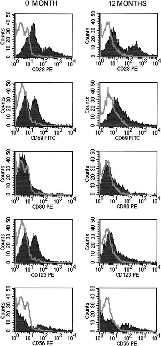 Fig. 1. Changes in NK and dendritic cell populations during ECP. / Results are for patient 4 before ECP began and after 12 months of ECP.