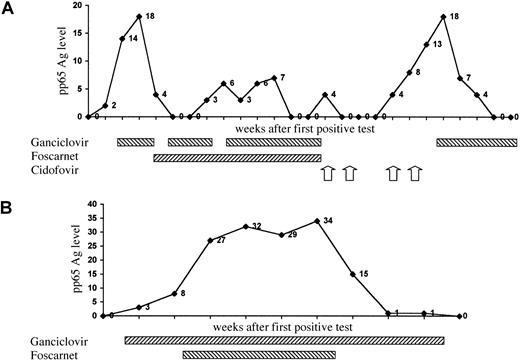 Fig. 1. Time course of CMV pp65 antigenemia and antiviral drugs administered. / (A) patient 1; (B) patient 2. The 4 arrows refer to each single dose of cidofovir.