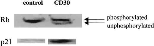 Fig. 1. Expression of Rb protein and p21 in Karpas 299 cells after CD30 activation. / After synchronization, cells were fed serum and allowed to grow. Forty hours after addition of serum, in the absence of HeFi-1 all the Rb protein expressed is in phosphorylated form (upper band), whereas the HeFi-1 treated cells demonstrate a significant amount of unphosphorylated Rb protein. p21 is not expressed in the control cells, whereas the CD30-activated cells have high p21 expression at 40 hours after CD30 activation.