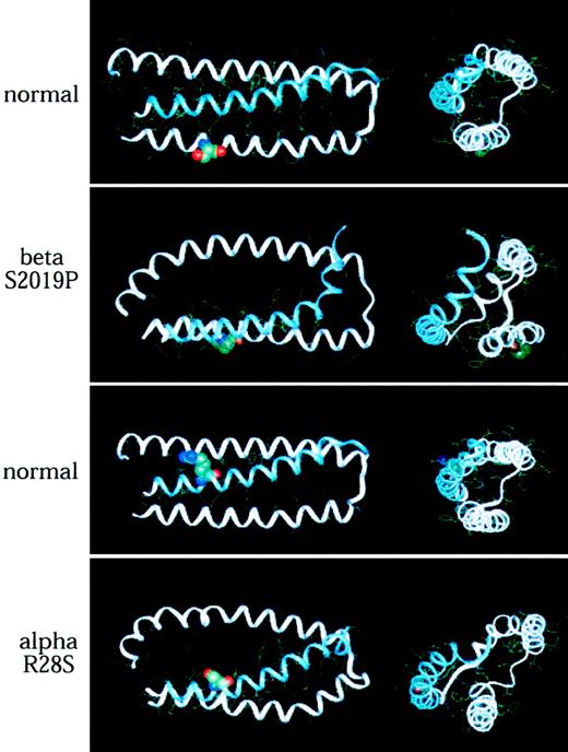 Fig. 4. Mutations of α- and β-spectrin disrupt the normal predicted structure of the spectrin self-association domain. / (Top pair) Structure of normal spectrin versus spectrin Providence, showing the position of the S→P amino acid replacement at codon β2019 (position 12 in the A helix). Note the predicted severe distortion of this helix, with loss of the β-spectrin pocket into which α-spectrin (helix C) docks. (Bottom pair) A similar analysis revealing the predicted effect of a mutation in codon 28 of α-spectrin (R28S), a mutation that leads to hereditary pyropoikilocytosis. Even though the serine in this mutation is hydrophilic like the residue it replaces (R), the loss of the 2 putative salt bridges formed by the lost arginine (Table 2) destabilizes the self-association binding site. In each model, longitudinal and end-on views are shown. The mutated residue is depicted in space-filled form.