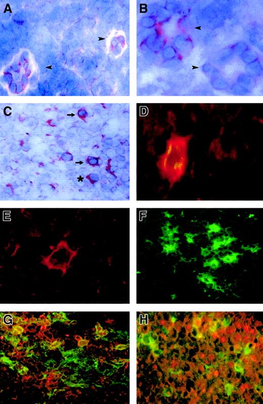 Fig. 1. FKN expression in lymph nodes. / FKN expression was tested by immunohistochemistry (A-C) and by immunofluorescence (D-H) in lymph nodes from 4 HIV-infected patients and 4 controls. (A) Two HEV cells in a T-cell zone of an HIV-uninfected patient. (B,C) T-cell zone in an HIV-infected patient. (D,G,H) Characterization of FKN-expressing cells in an HIV-infected patient, evidenced by a double-labeling experiment combining detection of FKN (red) and CD83 (D), CD123 (G), or CD79α (H) (green). Double-labeled cells appear in yellow. Single-labeling immunofluorescence experiments with the anti-FKN or the CD83 antibody are shown in panels E and F, respectively. → indicates DCs; ➤, HEV; *, plasma cell. Original magnification × 400 in panels B, D, and E and × 200 in other panels.