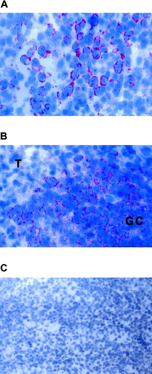 Fig. 2. FKN gene expression in lymph nodes. / FKN gene expression was analyzed in lymph nodes from 4 HIV-infected (A,B) and 4 uninfected (not shown) patients by in situ hybridization with an antisense probe. (A) T-cell zone. (B) Border between the germinal center (GC) and the T-cell zone (T). (C) Control hybridized with a sense probe. Original magnification × 400 in panels A and B and × 200 in panel C.