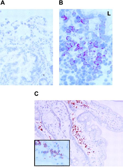 Fig. 5. FKN expression in the duodenum. / FKN expression was tested in the duodenum of 3 HIV-uninfected (A) or 2 HIV-infected (B) patients by immunohistochemistry (data not shown) or by in situ hybridization with an antisense probe. (C) CD79α-expressing cells in the duodenum of HIV-infected patients. Original magnification × 200 in panels A and C and × 400 in panel B and in the insert of panel C. L indicates digestive lumen.