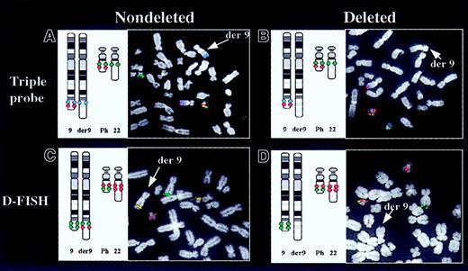 Fig. 1. Analysis of Ph+ metaphase cells with or without a deletion of the derivative chromosome 9 using the triple-probe or D-FISH systems. / Each panel shows a cartoon of the expected hybridization signals together with a partial metaphase. Using the triple-probe system (A,B), a blue signal is absent from the derivative chromosome 9 (der 9) in a cell carrying a deletion of that chromosome (B). Using the D-FISH system (C,D), note the absence of the colocalized red/green signal on the derivative chromosome 9 in a cell carrying a deletion of that chromosome (D).
