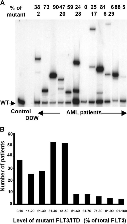 Fig. 4. Quantification and number of FLT3/ITD mutations. / (A) Semiquantitative radioactive PCR of 12 patients with AML. The relative percentage of the mutant(s) is shown above the gel. (B) Total level of mutant(s) detected in 224 FLT3/ITD+patients.